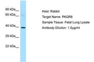 Image no. 1 for anti-Progestin and AdipoQ Receptor Family Member VIII (PAQR8) (C-Term) antibody (ABIN6750064) (PAQR8 antibody  (C-Term))