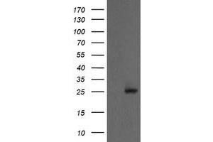 Image no. 1 for anti-Proteasome Subunit alpha 2 (PSMA2) (AA 50-234) antibody (ABIN1491568) (PSMA2 antibody  (AA 50-234))