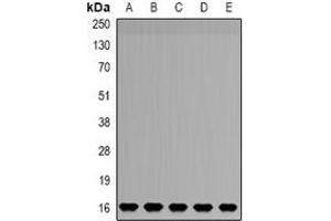 Western blot analysis of NDUFB5 expression in HepG2 (A), SW480 (B), mouse liver (C), mouse brain (D), rat kidney (E) whole cell lysates. (NDUFB5 antibody)