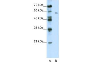 Western Blotting (WB) image for anti-BTB (POZ) Domain Containing 14A (BTBD14A) antibody (ABIN2461017) (BTBD14A antibody)