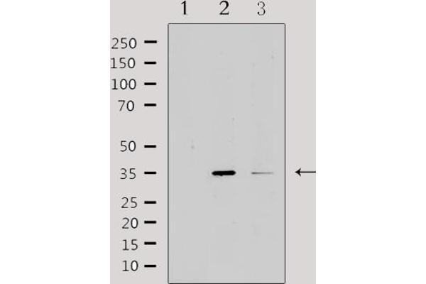 IL20RB antibody  (Internal Region)