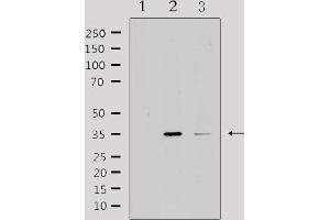Western blot analysis of extracts from various samples, using IL20RB Antibody. (IL20RB antibody  (Internal Region))