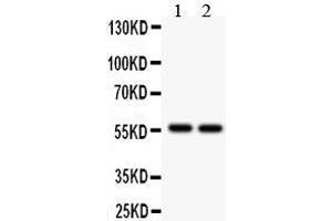 Anti- ALDH2 Picoband antibody, Western blotting All lanes: Anti ALDH2  at 0. (ALDH2 antibody  (N-Term))