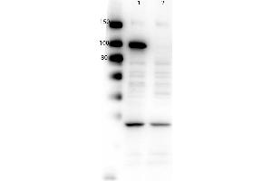 Western Blotting (WB) image for anti-Poly (ADP-Ribose) Polymerase 1 (PARP1) (C-Term) antibody (ABIN5596914)