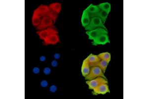 ABIN7095852 and ABIN7099914 staining Hela cells by IF/ICC. (UGT2B15 antibody)