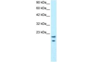 Western Blotting (WB) image for anti-C-Myc Binding Protein (MYCBP) antibody (ABIN2460298) (MYCBP antibody)