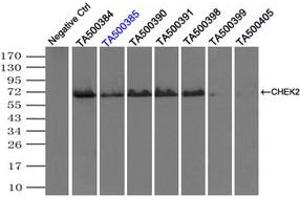 Image no. 1 for anti-Checkpoint Kinase 2 (CHEK2) antibody (ABIN1497498) (CHEK2 antibody)