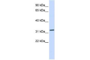 WB Suggested Anti-TPM1 Antibody Titration:  0. (Tropomyosin antibody  (Middle Region))