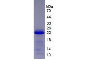 SDS-PAGE analysis of Human SCCA2 Protein.