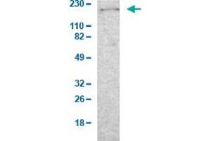 Western Blot analysis of human cell line RT-4. (Laminin beta 1 antibody  (AA 652-790))