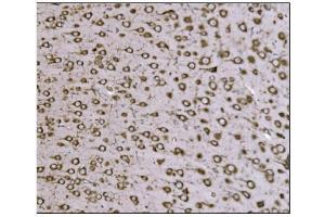 IHC analysis of TRAP Alpha/TRAPA/SSR1 using anti-TRAP Alpha/TRAPA/SSR1 antibody (ABIN7601975).