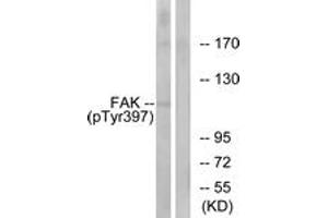 Western blot analysis of extracts from 293 cells treated with EGF 200ng/ml 30', using FAK (Phospho-Tyr397) Antibody. (FAK antibody  (pTyr397))