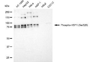Western blotting analysis using phospho-HSF1 (Ser326) antibody (ABIN7798865).