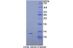 SDS-PAGE of Protein Standard from the Kit (Highly purified E. (PEX2 ELISA Kit)
