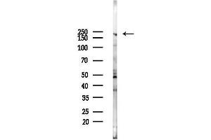 anti-Bromodomain Containing 4 (BRD4) (N-Term) antibody