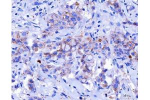 IHC analysis of Desmoglein 2/DSG2 using anti-Desmoglein 2/DSG2 antibody (ABIN7600804). (Desmoglein 2 antibody  (AA 24-1020))
