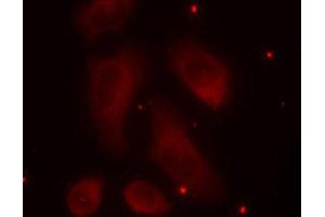 Immunofluorescence staining of methanol-fixed Hela cells using Phospho-LIMK1-T508 antibody. (LIM Domain Kinase 1 antibody  (pThr508))