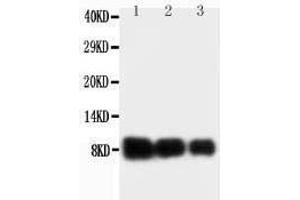 Anti-IL-8 antibody, Western blotting Lane 1: Recombinant Human IL-18 Protein 10ng Lane 2: Recombinant Human IL-18 Protein 5ng Lane 3: Recombinant Human IL-18 Protein 2. (IL-8 antibody  (C-Term))