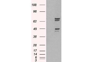 HEK293 overexpressing PTPN11 and probed with ABIN2559916 (mock transfection in first lane). (PTPN11 antibody  (C-Term))
