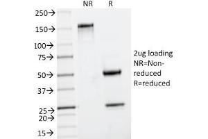 SDS-PAGE Analysis Purified Insulin Mouse Monoclonal Antibody (IRDN/794).