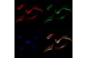 ABIN6265714 and ABIN6277332 staining Hela cells by IF/ICC.