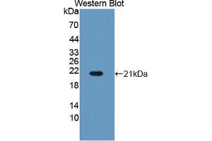 Detection of Recombinant HBb, Bovine using Polyclonal Antibody to Hemoglobin Beta (HBb) (Hemoglobin Subunit beta antibody  (AA 1-145))