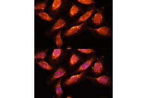 Immunofluorescence analysis of U-2 OS cells using RA antibody (ABIN7269798) at dilution of 1:100. (RAB1A antibody  (AA 1-205))