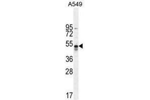 hTNFR-pS274 western blot analysis in A549 cell line lysates (35 µg/lane). (TNFRSF1A antibody  (AA 259-288))