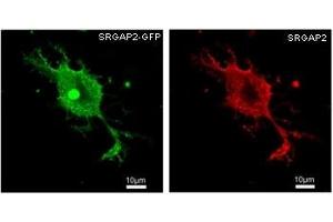 HEK293 overexpressing human SRGAP2 and probed with GFP (green) and SRGAP2 (red) antibody at 2. (SRGAP2 antibody)