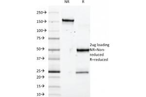 SDS-PAGE Analysis Purified SOX10 Mouse Monoclonal Antibody (SOX10/992). (SOX10 antibody  (AA 115-269))