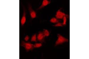 ABIN6275007 staining HT29 by IF/ICC. (CLIC4 antibody  (N-Term))