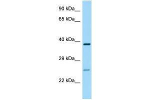 WB Suggested Anti-P2RY14 Antibody Titration: 1. (P2RY14 antibody  (C-Term))