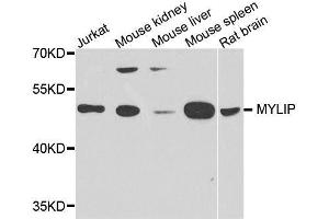 Western blot analysis of extracts of various cell lines, using MYLIP antibody. (MYLIP antibody  (AA 266-445))