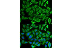Immunofluorescence analysis of HeLa cells using CYCS antibody. (Cytochrome C antibody)