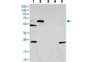 Western blot analysis of Lane 1: RT-4, Lane 2: U-251 MG, Lane 3: Human Plasma, Lane 4: Liver, Lane 5: Tonsil with C10orf33 polyclonal antibody .