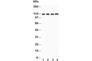 Western blot testing of NALP3 antibody and Lane 1:  HeLa;  2: MCF-7;  3: Jurkat;  4: HEPG2 (NLRP3 antibody  (AA 21-194))