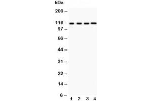 Western blot testing of NALP3 antibody and Lane 1:  HeLa;  2: MCF-7;  3: Jurkat;  4: HEPG2 (NLRP3 antibody  (AA 21-194))