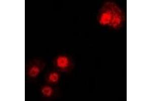 Immunofluorescent analysis of Alpha-tubulin 4a staining in U2OS cells. (TUBA4A antibody)