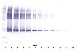 Image no. 1 for anti-serpin Peptidase Inhibitor, Clade A (Alpha-1 Antiproteinase, Antitrypsin), Member 12 (SERPINA12) antibody (ABIN465901)