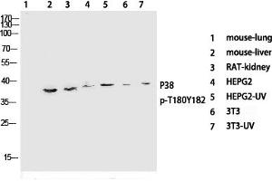 Western Blotting (WB) image for anti-Mitogen-Activated Protein Kinase 14 (MAPK14) (pThr180), (pTyr182) antibody (ABIN5955628) (MAPK14 antibody  (pThr180, pTyr182))