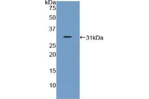 Detection of Recombinant GHR, Mouse using Polyclonal Antibody to Growth Hormone Receptor (GHR) (Growth Hormone Receptor antibody  (AA 36-266))