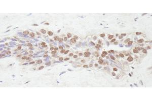 Immunohistochemistry (IHC) image for anti-Nuclear Receptor Coactivator 2 (NCOA2) (C-Term) antibody (ABIN7448683) (NCOA2 antibody  (C-Term))