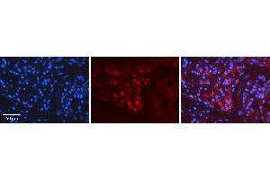 Rabbit Anti-RET Antibody Catalog Number: ARP30878_P050 Formalin Fixed Paraffin Embedded Tissue: Human Testis Tissue Observed Staining: Cytoplasm Primary Antibody Concentration: 1:600 Other Working Concentrations: N/A Secondary Antibody: Donkey anti-Rabbit-Cy3 Secondary Antibody Concentration: 1:200 Magnification: 20X Exposure Time: 0. (Ret Proto-Oncogene antibody  (C-Term))