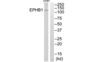 Western Blotting (WB) image for anti-EPH Receptor B1 (EPHB1) (C-Term) antibody (ABIN1852704) (EPH Receptor B1 antibody  (C-Term))