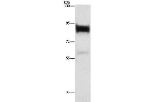 Western Blot analysis of Human prostate tissue using LTF Polyclonal Antibody at dilution of 1:400 (Lactoferrin antibody)