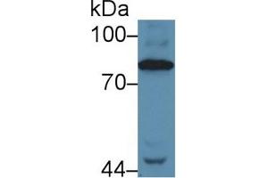 Western Blot; Sample: Human Serum; Primary Ab: 5µg/ml Rabbit Anti-Human C4 Antibody Second Ab: 0. (Complement C4 antibody  (AA 975-1336))