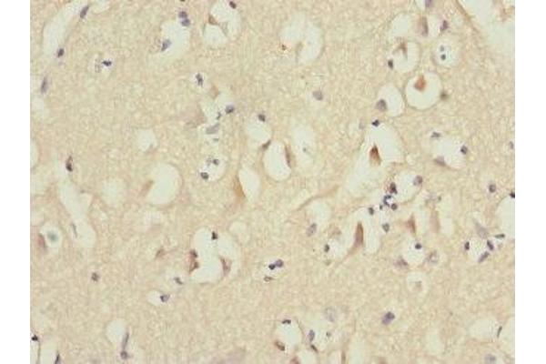 MID1 antibody  (AA 478-667)