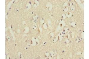 Immunohistochemistry of paraffin-embedded human brain tissue using ABIN7151071 at dilution of 1:100 (MID1 antibody  (AA 478-667))