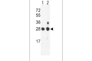 Western blot analysis of PSMB1 Antibody (C-term) (ABIN652802 and ABIN2842525) in mouse NIH-3T3 cell line(lane 1) and mouse bladder tissue(lane 2) lysates (35 μg/lane). (PSMB1 antibody  (C-Term))