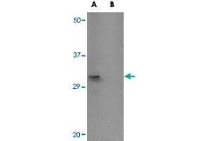Western blot analysis of ACOT13 in HepG2 cell lysate with ACOT13 polyclonal antibody  at 1 ug/mL in (A) the absence and (B) the presence of blocking peptide.